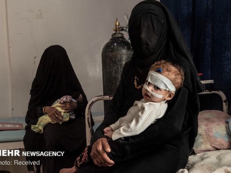 ۲ میلیون کودک یمنی بین مرگ و زندگی به سر می‌برند